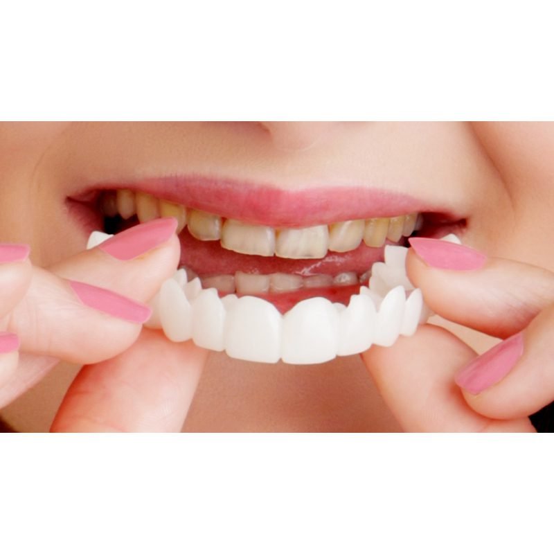 snap-on-smile-1.jpg