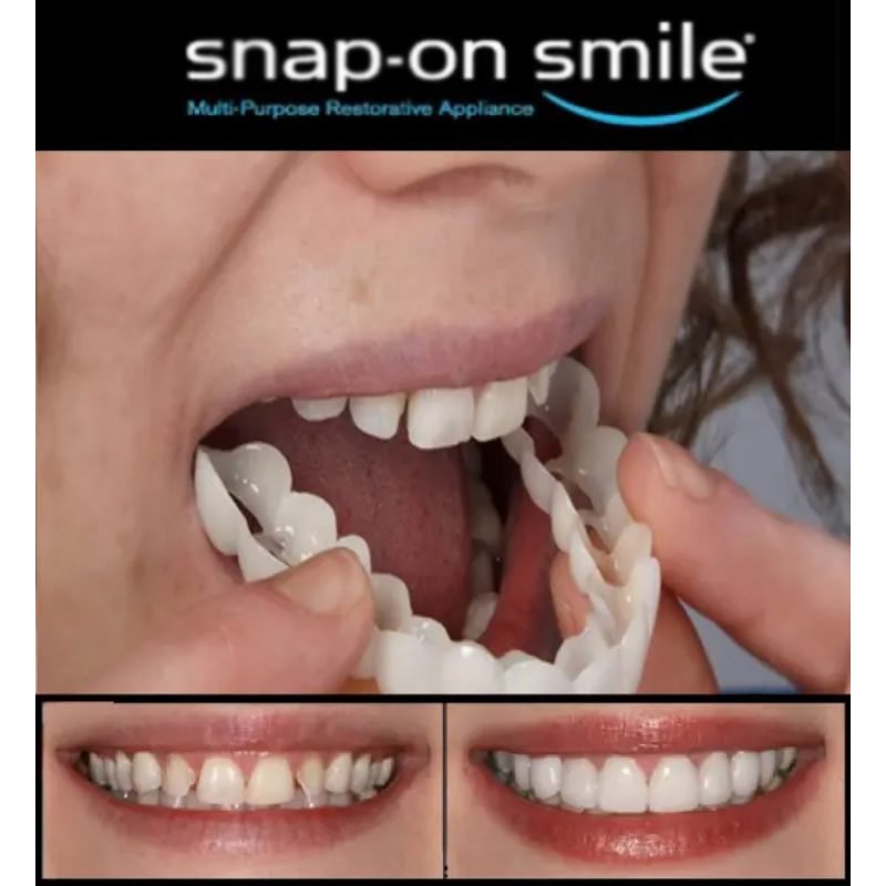 snap-on-smiles-1.jpg